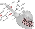 Autism risk in children could be predicted by mutations in paternal sperm