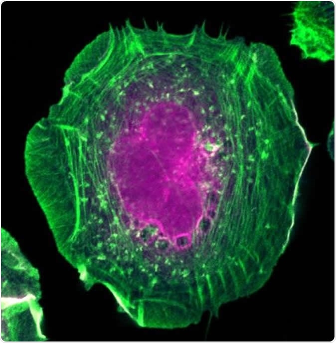 HeLa cell expressing the proximity interaction probe BirA*-Flag-active RAC1. Actin filaments are in green and biotinylated proteins are in magenta. Image Credit: Amélie Robert (IRCM)
