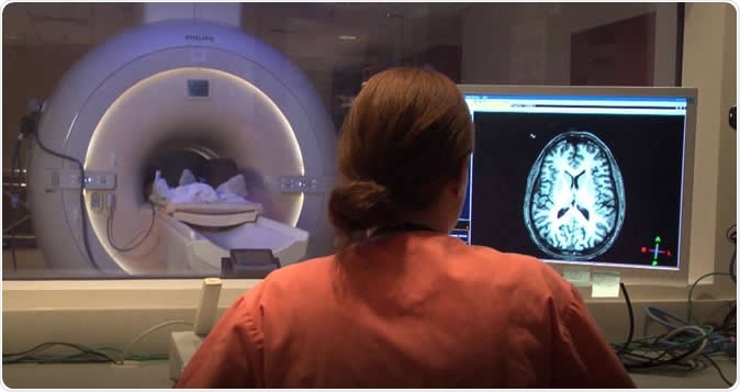 A technician viewing brain MRI images