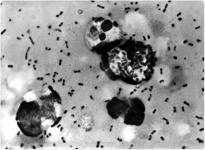 Yersinia pestis bacteria. Image Credit: Everett Historical / Shutterstock