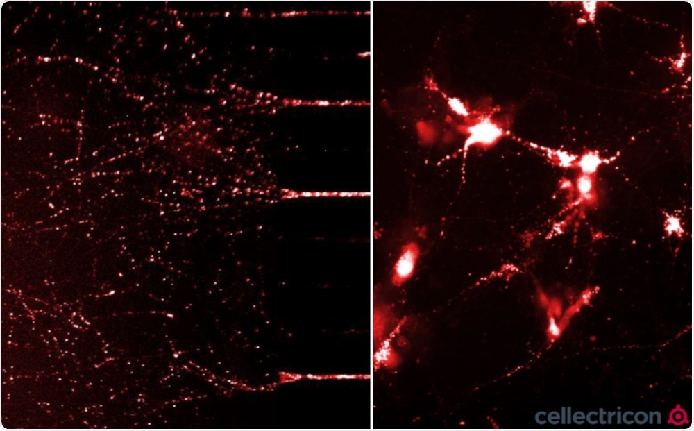 ATTO633 fluorescently-labelled alpha-synuclein PFFs were taken up, transported into the soma, and induced alpha-synuclein aggregation in mouse neurocortical primary cells. (L) Neurites filled with fluorescently-labelled alpha-synuclein seeds in a microfluidic co-culture system after 24 hours. (R) Alpha-synuclein seeds within the soma and neurites of mouse neurocortical primary cells after 24 hours. Experiment and imaging courtesy of Cellectricon
