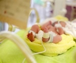 Preterm birth could be spotted early by ultrasound