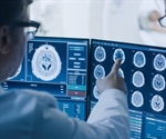 Artificial Intelligence (AI) in Cancer Care