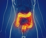 Immune cells repair damaged gut in children with IBD