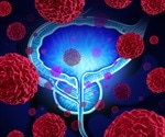 Targeted screening effective in reducing prostate cancer deaths