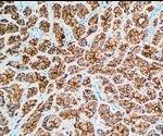 Multicolor Immunohistochemistry (IHC): Going Beyond a Single Color