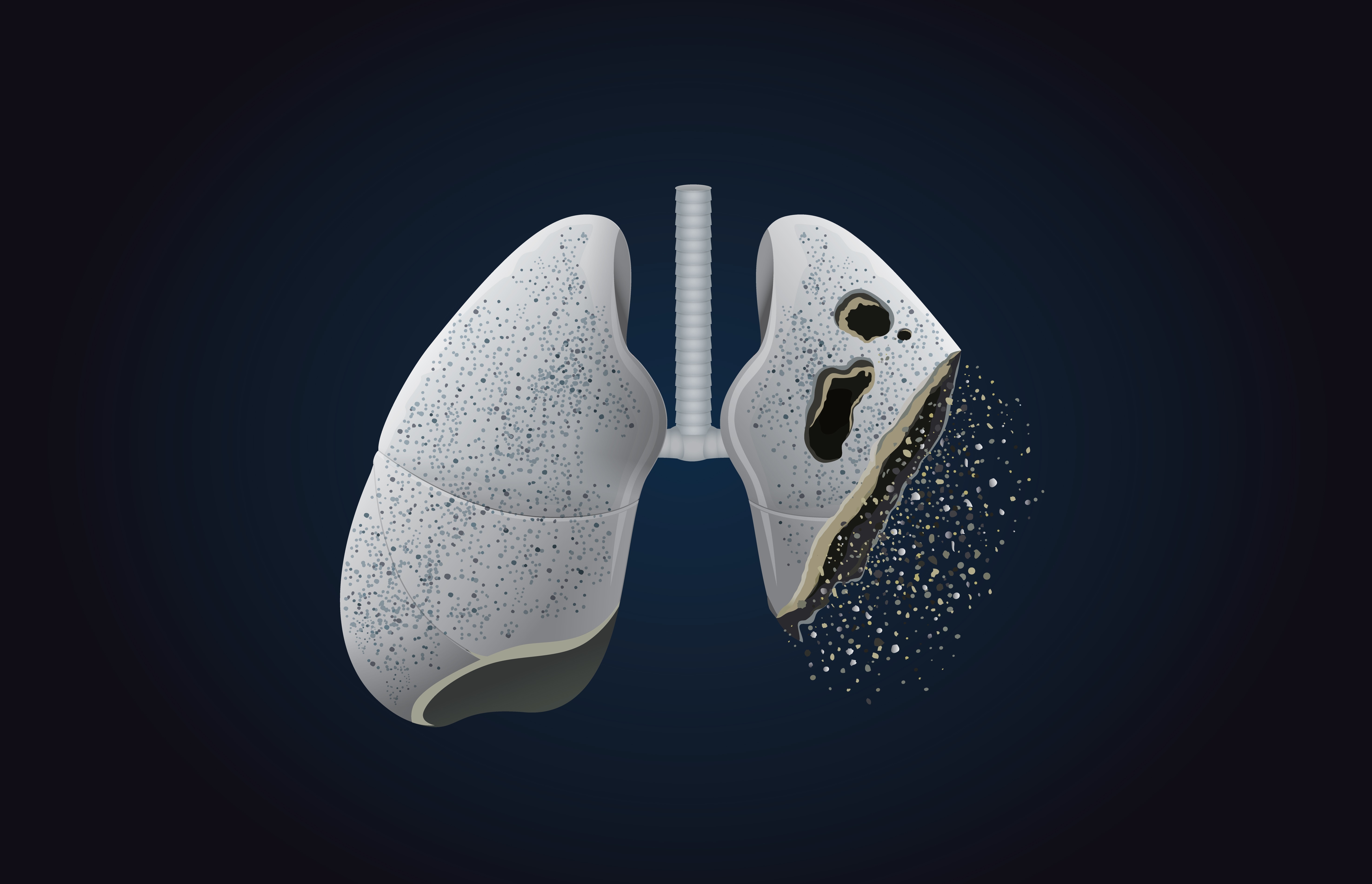 metal-scarring lung