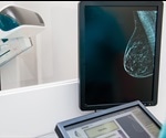 New kind of AI improves breast cancer risk prediction