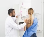 Breast cancer screening age should be lowered to 35 for those with a family history