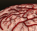 Blood-clotting factor may cause Alzheimer's disease