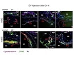 Extracellular Vesicles Role in Differentiating Monocytes into Immature Dendritic Cells