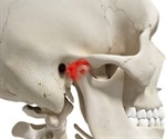 TMJ disorders could be treated with tissue-engineered implants after successful animal study