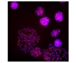 People born with short telomeres found to have short-lived immune system cells