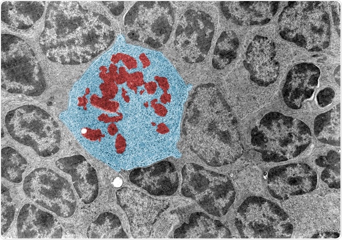 False colour transmission electron microscope (TEM) micrograph of a mitotic cell (blue) surrounded by interphase cells. The chromosomes (red) appear as dark clumps.