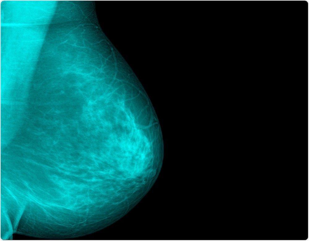 Breast density will be used to determine breast cancer risk, under the new regulations