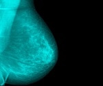 Mammograms will soon include breast density says FDA