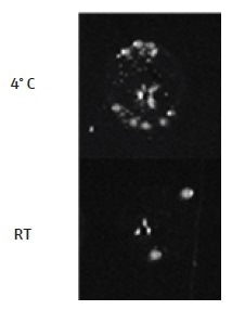 Temperature of cells for DNA addition step. It is very important for competent E. coli cells to be kept at 4° C at all times prior to the heat shock step. Shown here are DH5α cells which were either maintained at 4 °C or moved temporarily to the CyBio® FeliX deck at room temperature (RT; <2 minutes), for the DNA addition step. The transformation efficiency becomes very low when the DNA addition is carried out at room temperature. Therefore, during the DNA addition step on the CyBio® FeliX, E. coli cells must be kept at 4 °C. This can be achieved by placing the cell plate on a CoolRack® XT PCR96, cooled to 4 °C, and transferring the CoolRack® (containing the cell plate) to the CyBio® FeliX deck for the addition of the DNA.