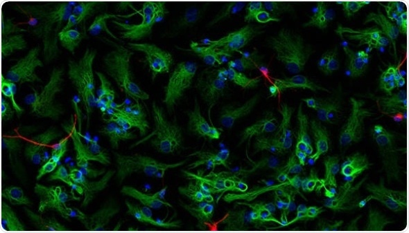 Neural precursor cells form into neurospheres, which then differentiate into astrocytes (green) and new neurons (red).
