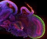 Miniature brains that can move muscles, grown in the lab