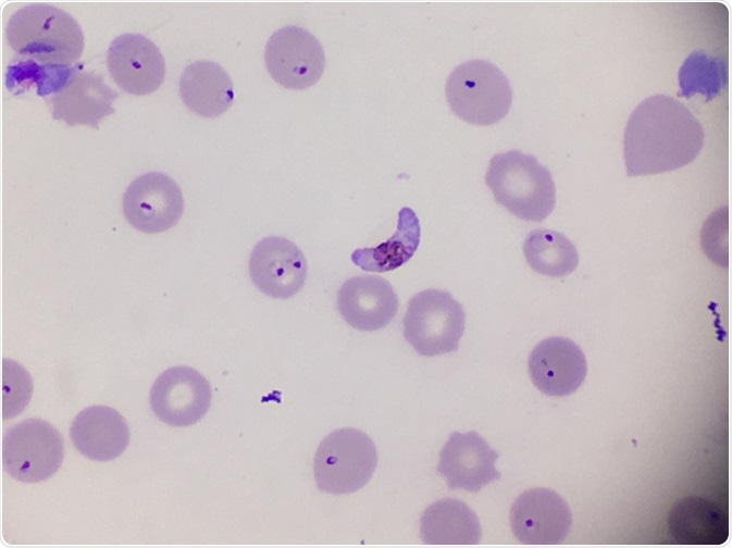 Plasmodium falciparum gametocyte in blood smear