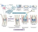 Researchers report new regenerative medicine approach for treating osteoarthritis of the knee