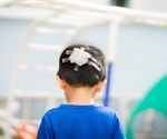 Experts issue new treatment guidelines for traumatic brain injury in children