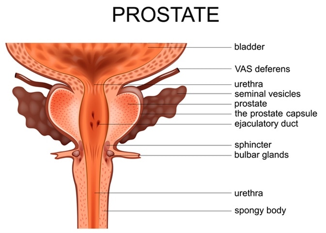 prostate one lobe larger)