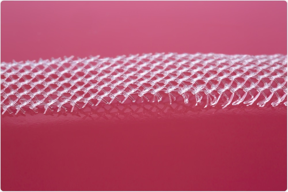 Vaginal mesh was previously used to treat urinary incontinence