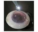 Study reveals a revolutionary way to treat eye injuries, prevent blindness