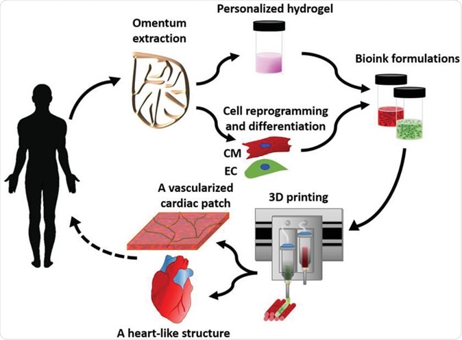 Concept schematic. An omentum tissue is extracted from the patient and while the cells are separated from the matrix, the latter is processed into a personalized thermoresponsive hydrogel. The cells are reprogrammed to become pluripotent and are then differentiated to cardiomyocytes and endothelial cells, followed by encapsulation within the hydrogel to generate the bioinks used for printing. The bioinks are then printed to engineer vascularized patches and complex cellularized structures. The resulting autologous engineered tissue can be transplanted back into the patient, to repair or replace injured/diseased organs with low risk of rejection. Image Credit: Nadav Noor  Assaf Shapira  Reuven Edri  Idan Gal  Lior Wertheim  Tal Dvir