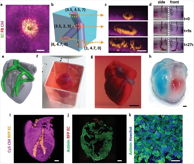Printing thick vascularized tissues. a) A top view of a lumen entrance (CD31; green) in a thick cardiac tissue (actinin; pink). b) A model of a tripod blood vessel within a thick engineered cardiac tissue (coordinates in mm), and c) the corresponding lumens in each indicated section of the printed structure. d) Tissue perfusion visualized from dual viewpoints. e–k) A printed small‐scaled, cellularized, human heart. e) The human heart CAD model. f,g) A printed heart within a support bath. h) After extraction, the left and right ventricles were injected with red and blue dyes, respectively, in order to demonstrate hollow chambers and the septum in‐between them. i) 3D confocal image of the printed heart (CMs in pink, ECs in orange). j,k) Cross‐sections of the heart immunostained against sarcomeric actinin (green). Scale bars: (a,c,h, i,j) = 1 mm, (g) = 0.5 cm, (k) = 50 µm.