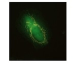 Damaged mitochondria use 'eat me' signals for mitophagy