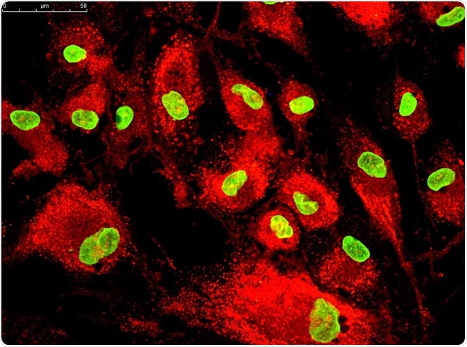 Mesenchymal stem cells labeled with fluorescent probes