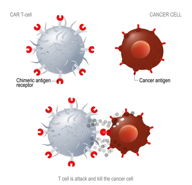CAR T immunotherapy. Artificial T cell receptors are proteins that have been engineered for cancer therapy (killing of tumor cells). Image Credit: Designua / Shutterstock