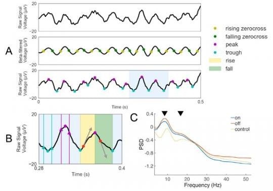 Novel measures of PD-related brain activity detected with scalp electroencephalography