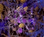 Conformation-Specific Aβ Antibodies - Future of Alzheimer’s Research