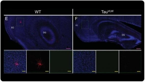 Dysfunctional neurons repaired in dementia mouse model