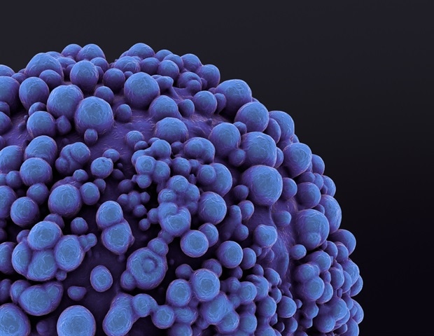 Nomogram helps predict anal cancer risk in HIV patients