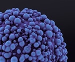 Oral cancer more common among Americans with HPV16 viral infections