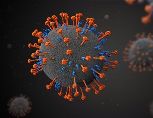 New collaboration launched to support the development of vaccines against henipavirus