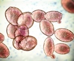 Toxin-producing yeast strains may damage the gut of patients with inflammatory bowel disease