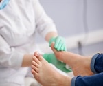 Pilot clinical study results of laser treatment for toenail fungus presented