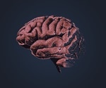Traumatic brain injury and Alzheimer's disease share common trajectories