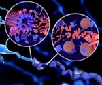Alzheimer's disease may be caused by infectious proteins called prions