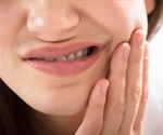 What is Dentin Hypersensitivity?