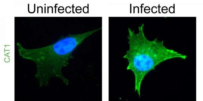 This image shows increased expression of an arginine transporter (CAT1, green) in host cells infected with Toxoplasma parasites (nuclei stained blue). Image Credit: Indiana University