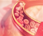 Not all good cholesterol helps to protect arteries from becoming clogged with fatty deposits