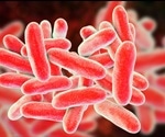 Wearable sensors show how antibiotic-resistant bacteria spread through hospital wards