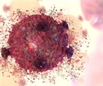 New component of cell death process could play key role in infection-fighting strategy