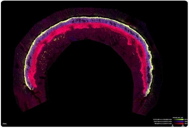 Mouse retina measured for lipids at 10 µm in Zoom mode. Scale bar indicates 100 µm (Image courtesy Jeffrey Spraggins, Ph.D., Mass Spectrometry Research Center, Vanderbilt University)